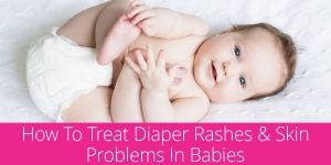 How to Treat Diaper Rashes & Skin Problems in Babies