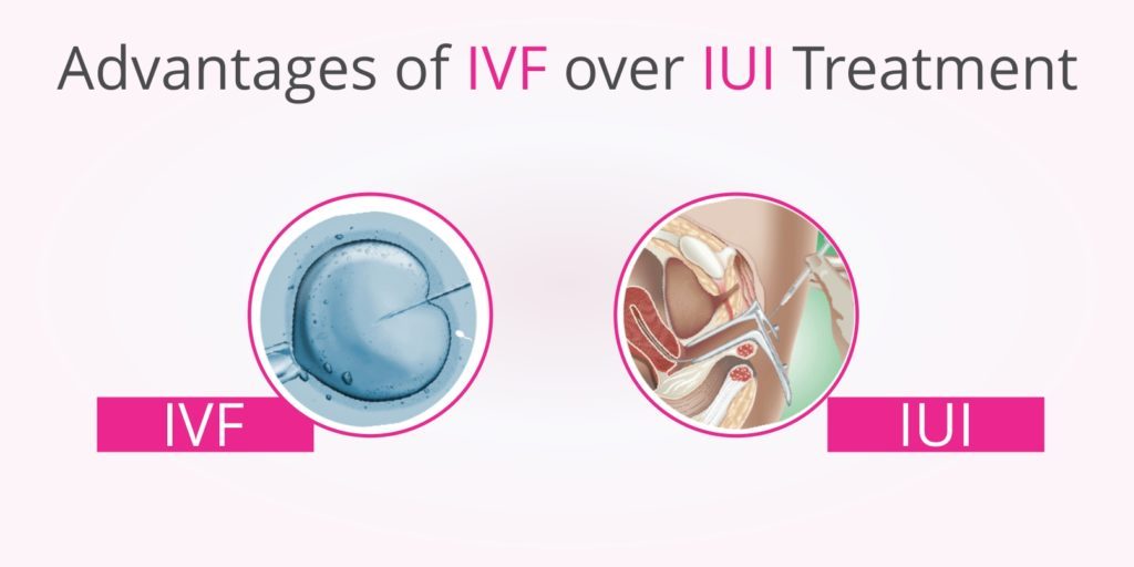 Advantages of IVF over IUI Treatment