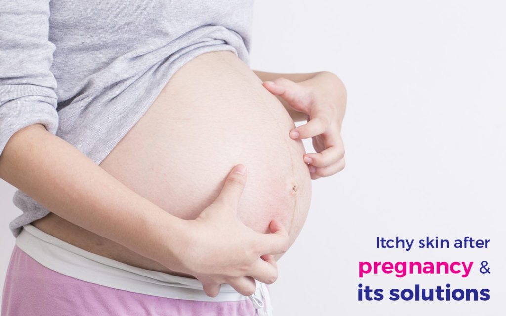Itchy skin after pregnancy & its solutions