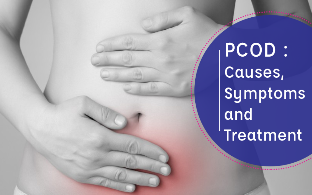 PCOD : Causes, Symptoms, and Treatment