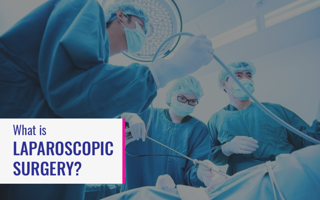 What is Laparoscopic Surgery?