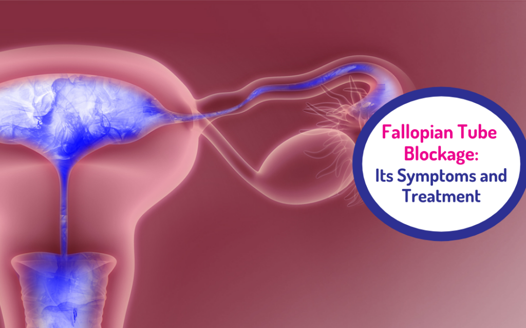 Fallopian Tube Blockage: Its Symptoms and Treatment