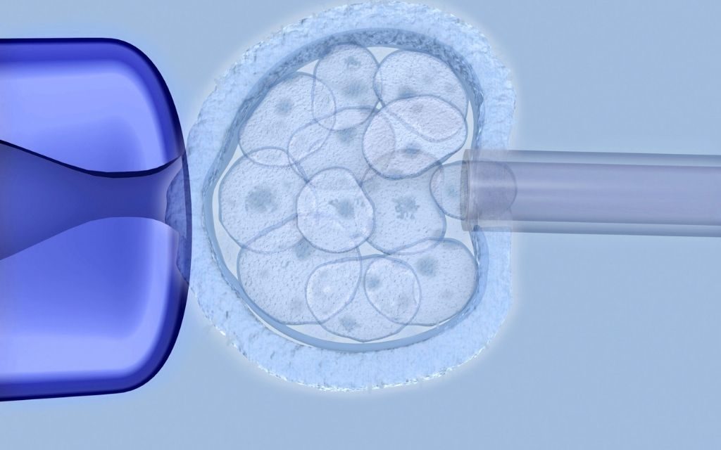 7 Crucial Tasks That An Embryologist Performs During IVF Treatment 5 Embryo transfer animated image