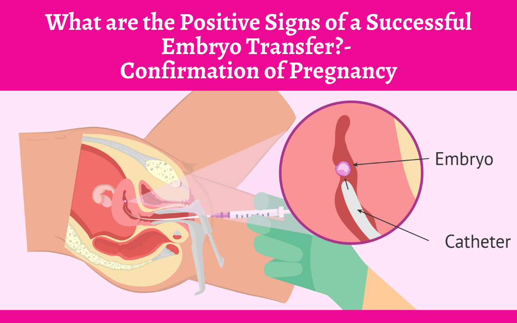 What are the Positive Signs of a Successful Embryo Transfer