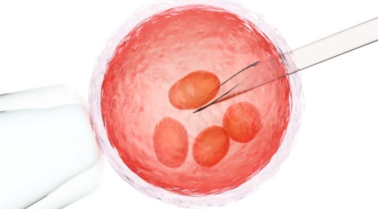 Retrieval of the egg from an ovary. 1