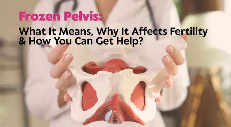 Frozen Pelvis- What It Means, Why It Affects Fertility & How You Can Get Help- featured image